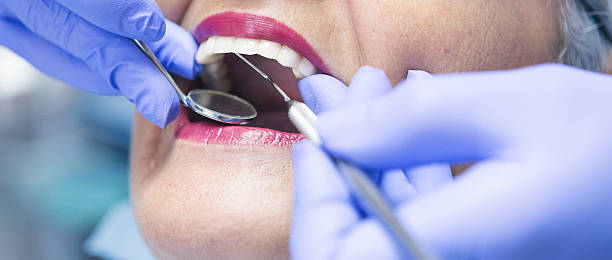 Best Broken Tooth Emergency  in Lake Los Angeles, CA